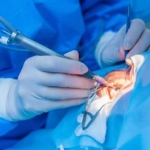 default-eye-hospitals-3